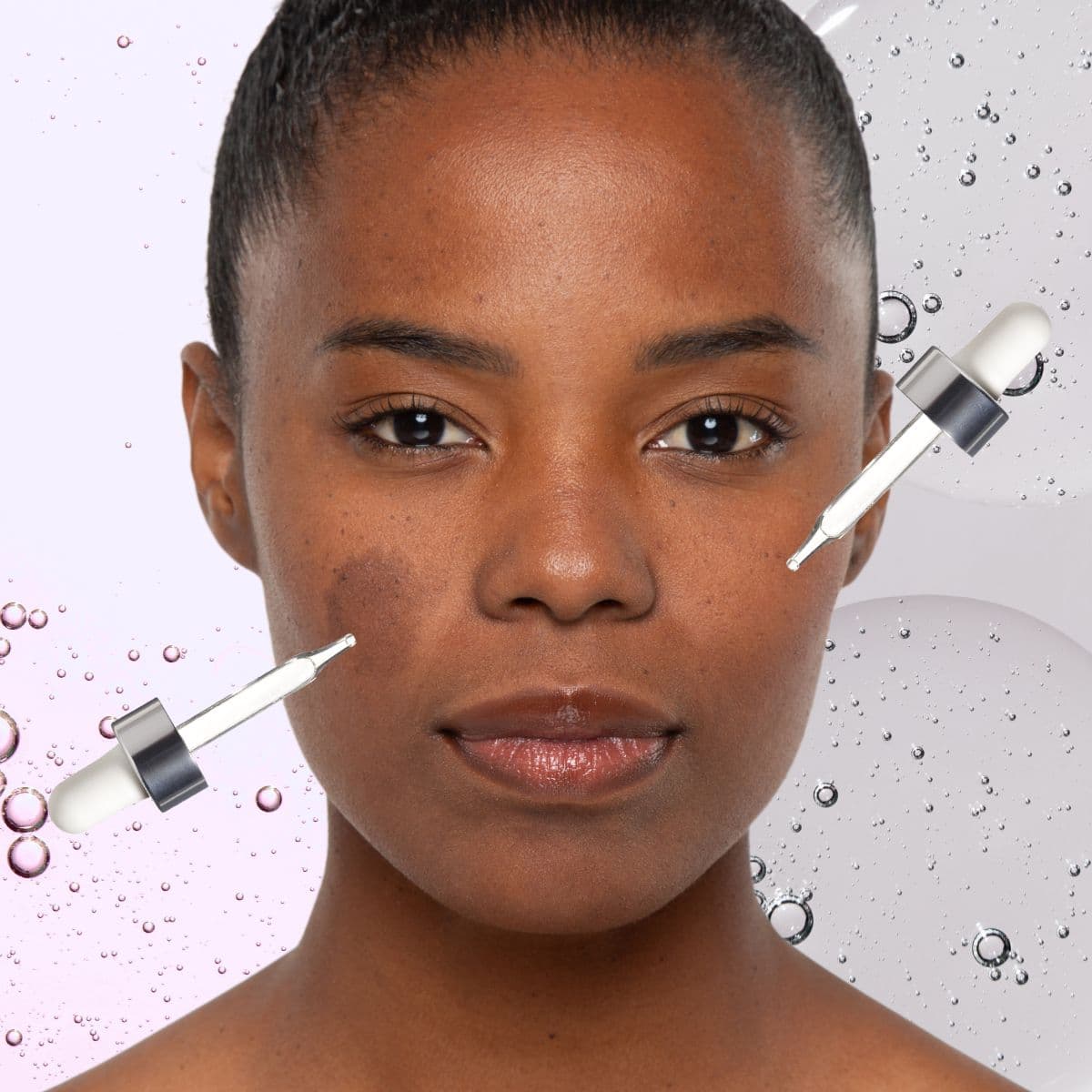 Azelaic Acid vs. Niacinamide: Which Is Better for Dark Spots?